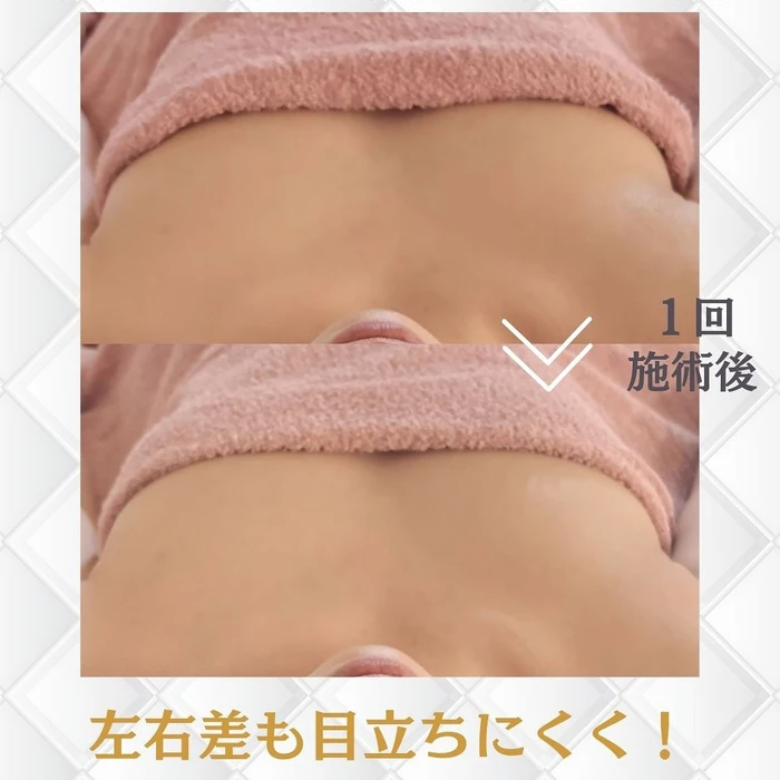 画像281