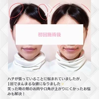 画像313