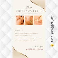 画像314