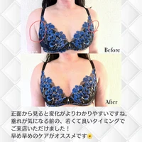 画像322