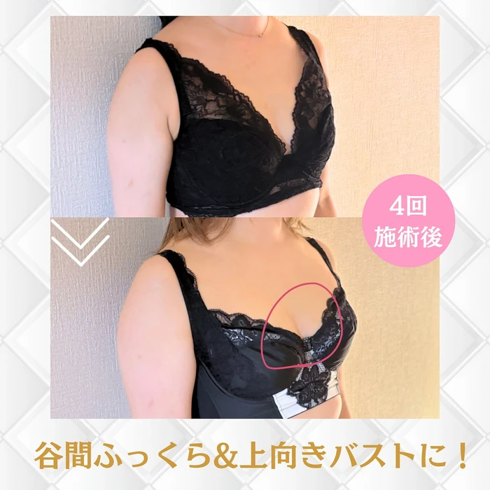 画像329