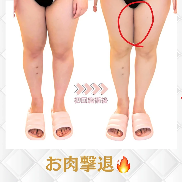 画像374