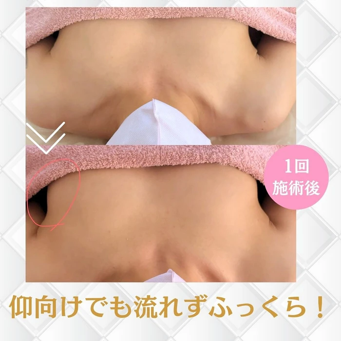 画像389