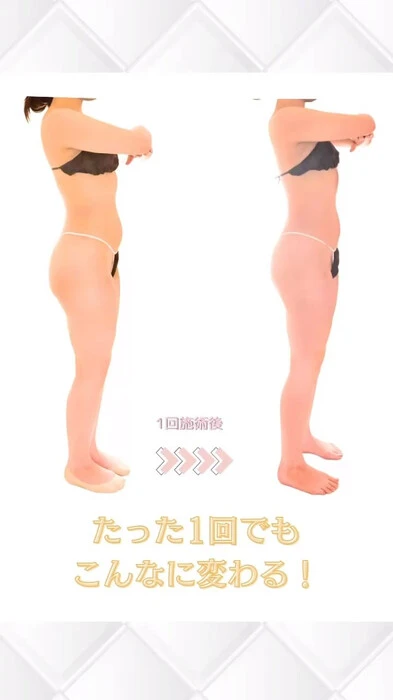 画像417